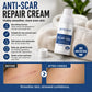 Scar Fading Ointment