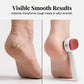 🏆LAST DAY SALE 49% OFF🔥Double-Sided Foot Scraper for Callus Removal